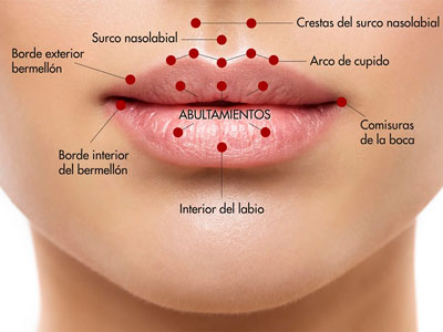 Ácido Hialurónico en Labios