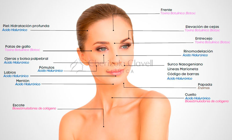 Ácido Hialurónico y Toxina Botulínica