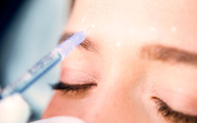 5 aplicaciones del botox que seguramente no conocías