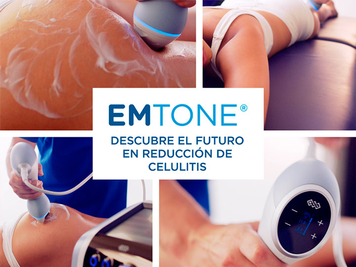 Celulitis con Emtone